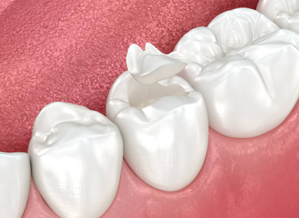 Best Dental Exams and Cleanings  in Roslyn, NY